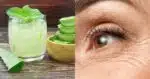 Receita caseira potente com 4 ingredientes suga todas suas rugas em minutos - Foto: Montagem