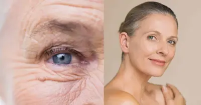1 único ingrediente elimina sinais da idade de vez e deixa pele lisa como de porcelana do dia pra noite