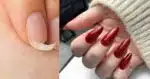 Unhas quebradas e com esmalte vermelho (Fotos: Canva)