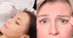 Receita melhor que botox para acabar com as rugas (Foto: Divulgação)