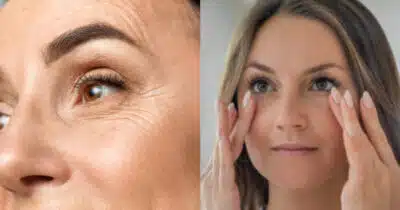 Fim dos pés de galinha e flacidez: Melhor colágeno do mundo (Foto: iStock/Montagem TV Foco)
