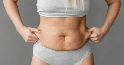 O fim da flacidez no corpo: 7 segredos eliminam pele caída e rejuvenescem qualquer um em 2025