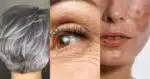 3 receitas para acabar com o grisalho, rugas e manchas na pele (Foto: Reprodução/ Internet)