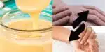 Receita natural para acabar com o ressecamento das mãos (Reprodução: Montagem TV Foco)