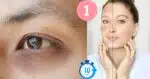 Mulheres com olheiras e manchas na pele (Foto: Reprodução / Canva / Montagem TV Foco)