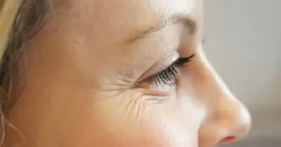 Tchau, pés de galinha: Segredo popular elimina terror das rugas nos olhos e rejuvenesce qualquer mulher