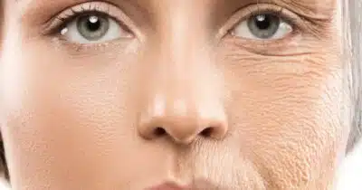 Imagem PreCarregada