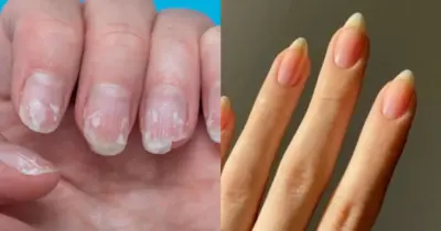 Tchau, unhas fracas e quebradas: 4 truques caseiros para fazer inveja