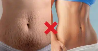Imagem PreCarregada