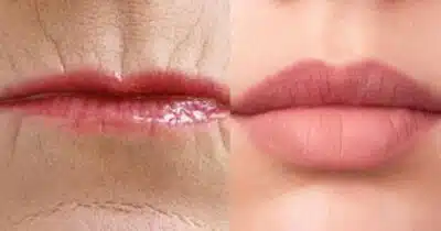 Imagem PreCarregada