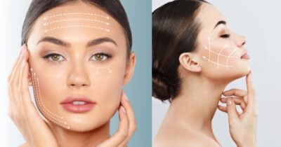 Harmonização facial caseira - Montagem: TVFOCO