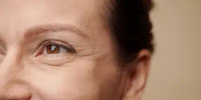 Veja como eliminar as rugas (Foto: Canva)