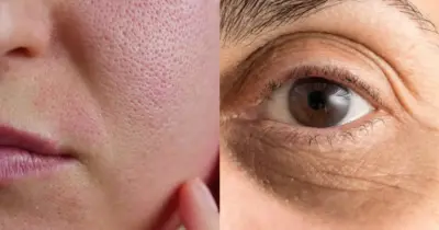 Fim das olheiras e poros dilatados: 1 único ingrediente tira o aspecto de cansada e seca a pele oleosa
