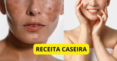 Imagem PreCarregada