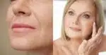 Preenchimento natural acaba com o bigode chinês em 4 passos (Reprodução/Montagem TV Foco/Canva)