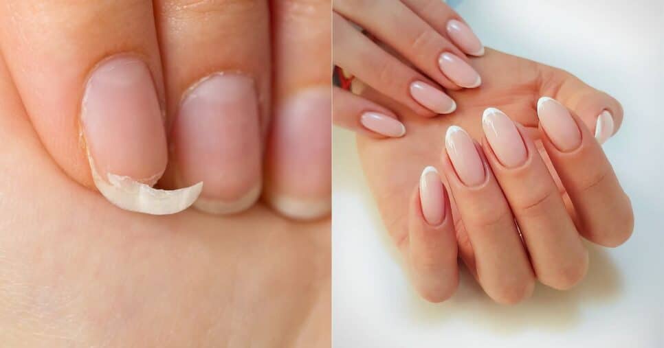Mistura com 3 ingredientes acelera o crescimento das unhas (Reprodução/Montagem TV Foco/Canva)