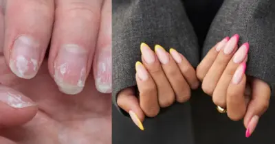 Fim da quebra e gastos com alongamento: Receitinha com 1 ingrediente faz unhas durarem quase eternamente