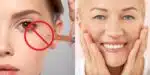 Botox caseiro para pele de bebê (Reprodução: Montagem TV Foco)