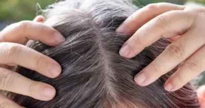 Rejuvenescem e previnem os fios brancos: 4 truques para evitar cabelos grisalhos sem precisar pintar