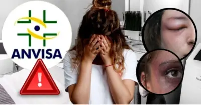 Inchaço e hematomas: Denúncia contra nº1 das donas de casa acende alerta da ANVISA em Campinas, SP