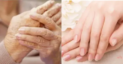 100% jovem: Mistura com 3 ingredientes traz FIM das rugas nas mãos de mulheres 50+