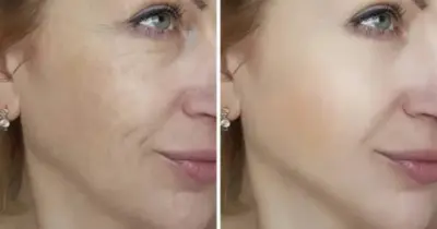Fonte da juventude: Mistura milagrosa com 4 ingredientes salva mulheres 50+ com FIM das rugas