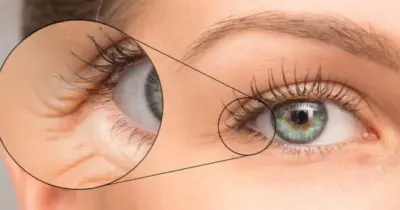 Elixir da juventude: Único produto barra surgimento das rugas e irá rejuvenescer qualquer mulher