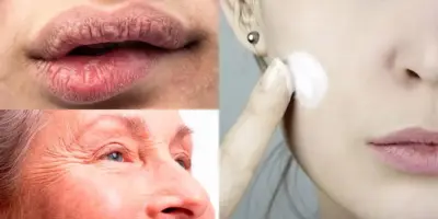 Adeus, rugas e lábios rachados: Receita com 2 ingredientes para mulheres 40+ começarem o Outono com pele lisa