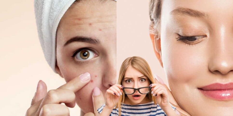 Fim das rugas e acnes com 1 único ingrediente popular (Reprodução: Montagem TV Foco)