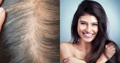 Fim do aplique e clínicas de estética: 7 passos infalíveis engrossam cabelos finos e ralos