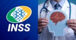INSS libera benefício a doença que atormenta 11M brasileiros (Foto: Reprodução/ Internet)