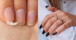 Ilustrações antes e depois de unhas (Fotos: Canva)