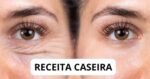 Vinagre e +1 ingrediente suga as rugas em 12 minutos e faz 60+ voltarem aos 30 outra vez - Foto: Montagem