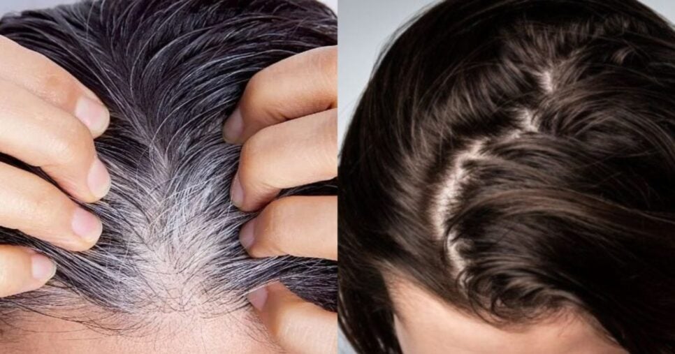 Receitinha com 1 ingrediente dá fim ao cabelo branco em 20 minutos - Foto; Internet