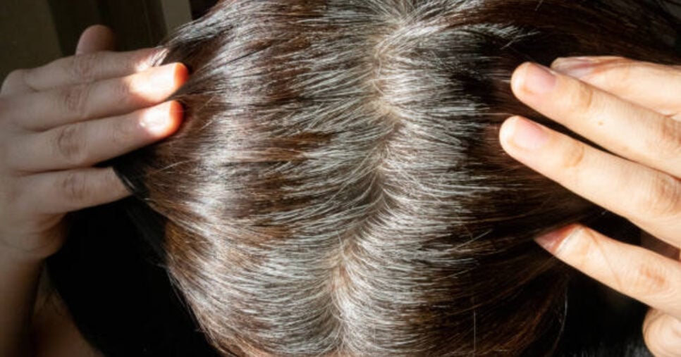 Cabelo branco vai chegar ao fim com essa receita prática (Foto: Getty Images)