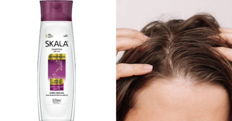 Conheça o shampoo para cabelos oleosos (Foto: Montagem TV Foco)