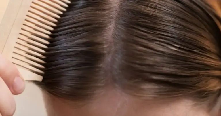 Raiz oleosa e pontas secas? 5 shampoos para cuidar dos cabelos mistos Raiz oleosa e pontas secas? 5 shampoos para cuidar dos cabelos mistos
