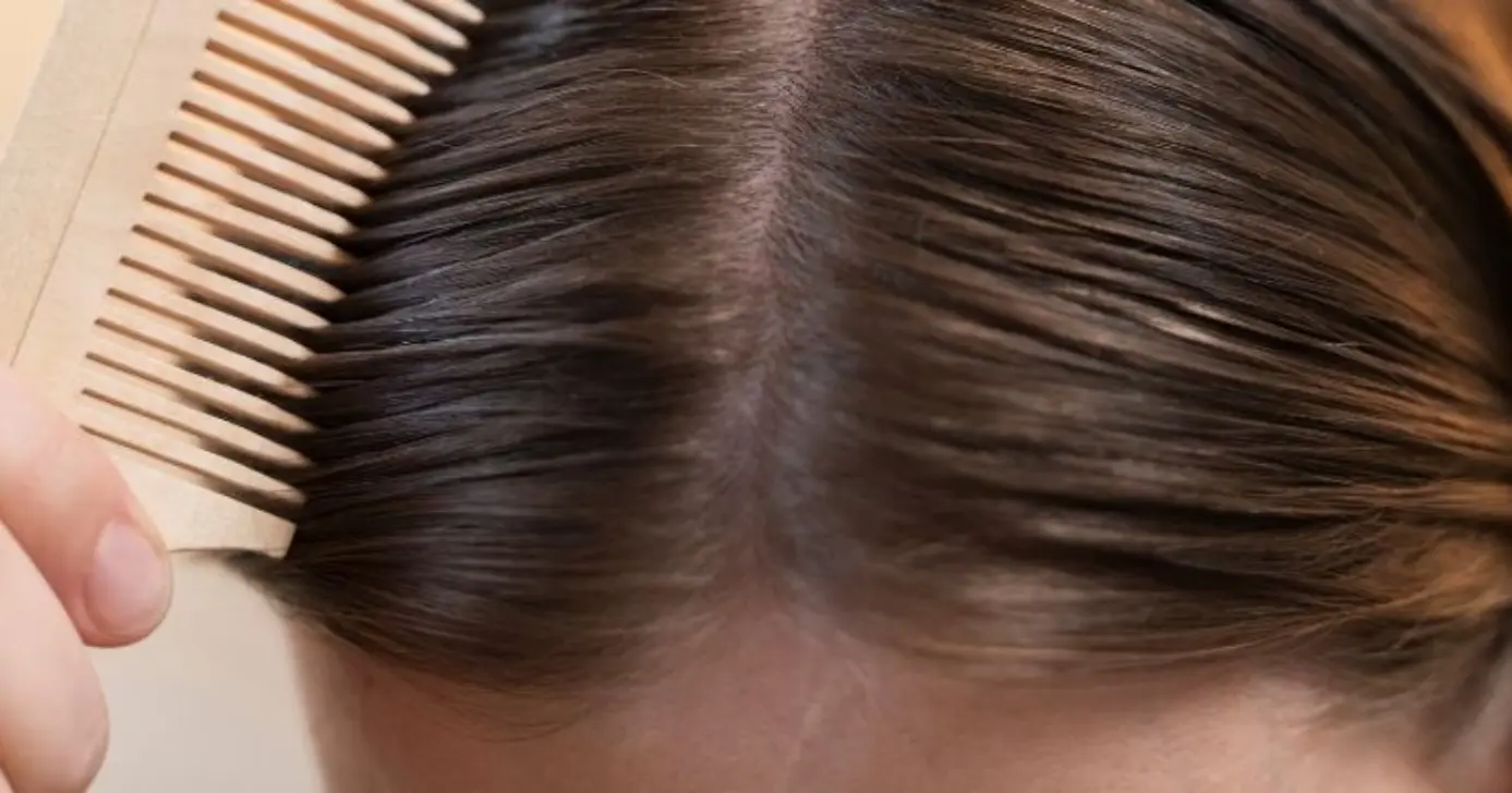 Adeus ao cabelo oleoso (Foto: Divulgação)