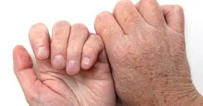 Mãos lisinhas em 15 min: Receita com azeite e outro ingrediente simples acaba manchas e rugas