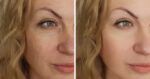 Receitinha com só 2 ingredientes recupera o colágeno - (Montagem / TV FOCO)