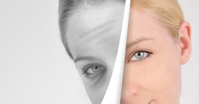 Rugas sugadas com essa máscara facial (Foto: Divulgação)