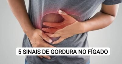 5 sinais silenciosos gordura no fígado descobertos (Foto: Reprodução/ Internet)