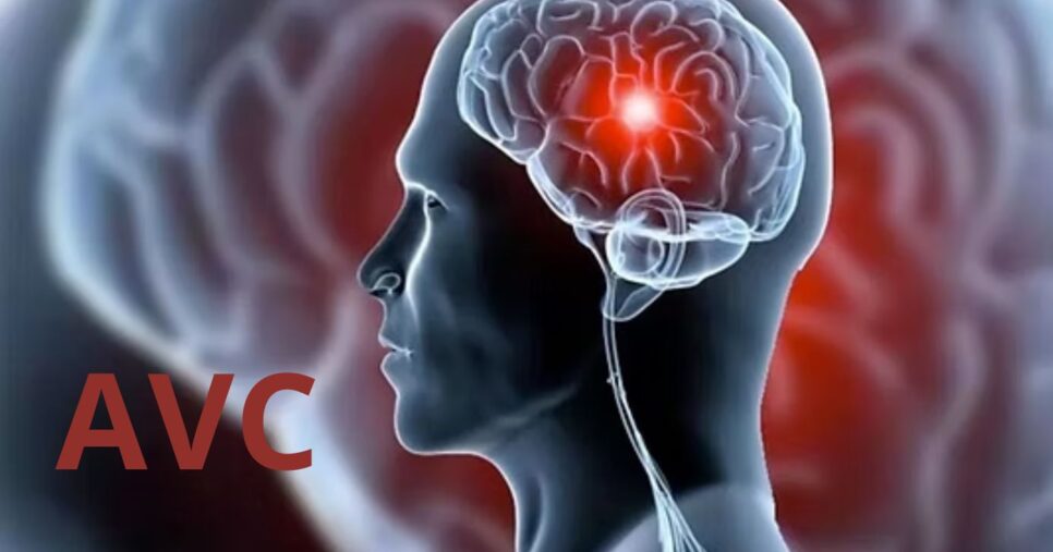 Acidente Vascular Cerebral (AVC) - Foto: Internet