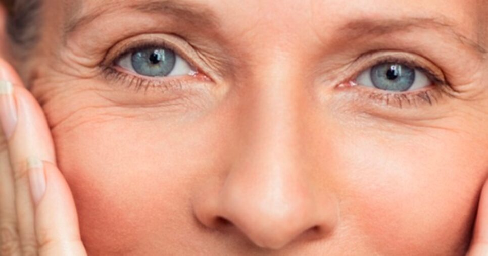 Botox caseiro: 3 ingredientes acabam com rugas das idosas (Foto: Reprodução/ Internet)