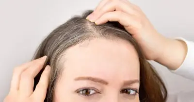 Falência da tinta: Mistura com 3 ingredientes escurece o cabelo branco e salva fios