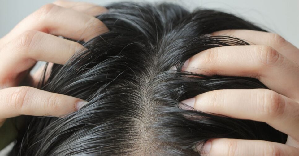 Cabelo oleoso (Foto: Canva)