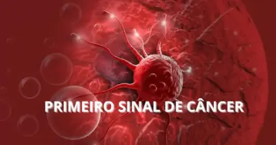 Oncologista revela 1º sinal de câncer que pode passar despercebido