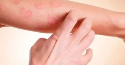 Cuidado: 5 sintomas silenciosos que indicam câncer de pele e você deve ir ao médico às pressas