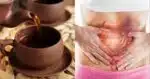 Estes são os 5 melhoras chás para ajudar a soltar o intestino - Foto: Internet
