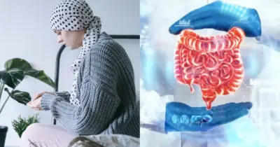 Atenção: 5 sintomas silenciosos que indicam câncer no intestino e você deve ir ao hospital IMEDIATAMENTE